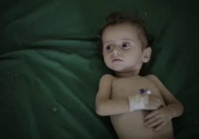 Jemen unterernährtes Kind  | Foto: Foto: UNICEF Deutschland