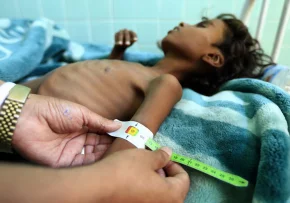 Jemen Kind  | Foto: Foto: UNICEF Deutschland